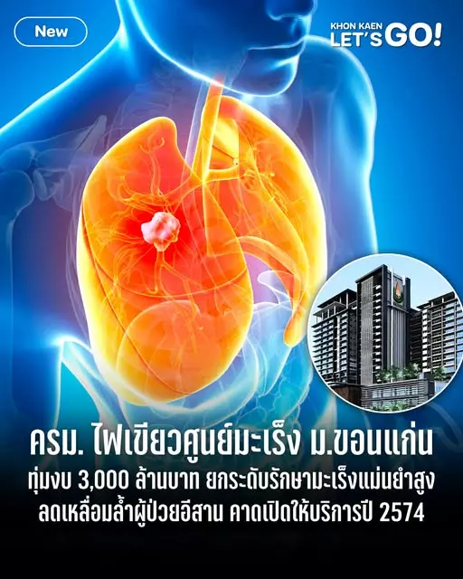ครม.ทุ่ม 3 พันล้าน สร้างศูนย์โปรตอนรักษามะเร็ง ที่ ม.ขอนแก่น คาดเปิดปี 74